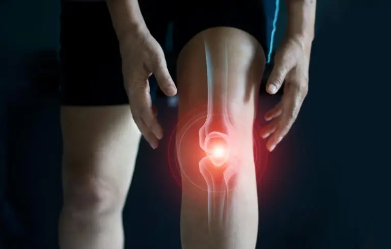 Joint inflammation on dark background.